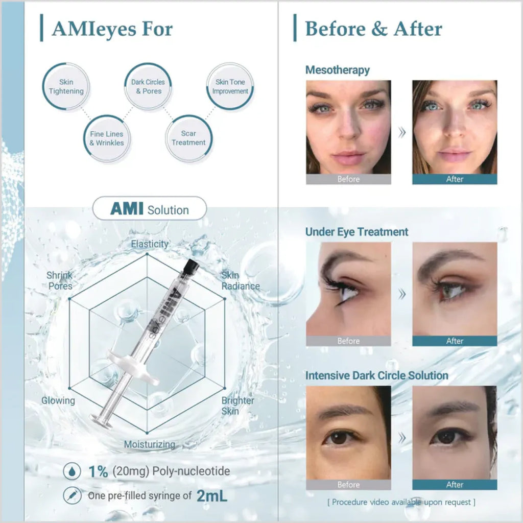 AMI Eyes filler for Dark Circles At Best Price In Pakistan - Made in Korea