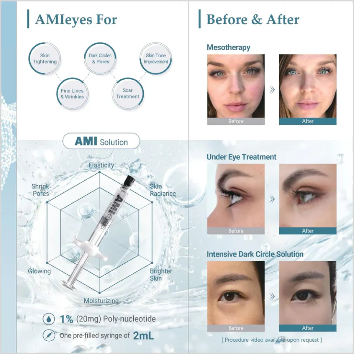 AMI Eyes filler for Dark Circles At Best Price In Pakistan - Made in Korea