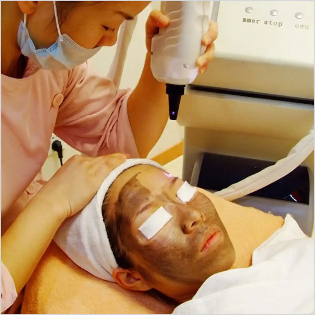Black Carbon Gel Deep Cleaning Moisturizing Face Cream For ND Yag Laser Skin Rejuvenation Removal Blackhead Whitening Skin Care