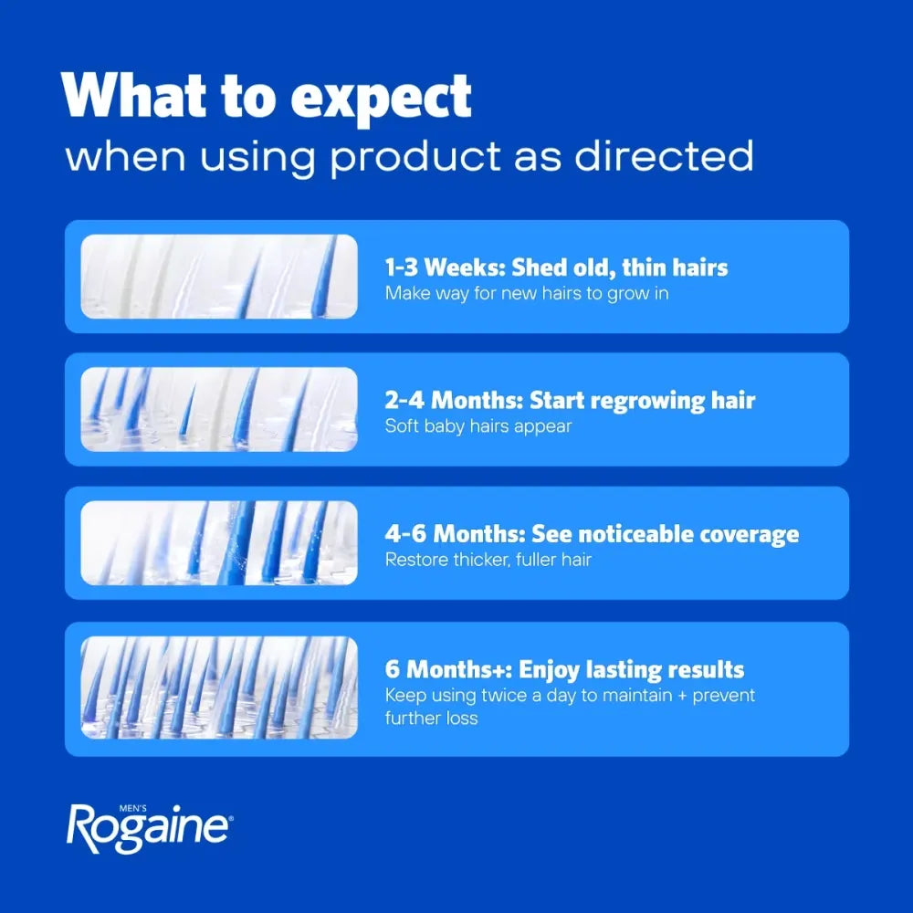 Men's Rogaine/Regaine Minoxidil Topical Solution - Extra Strength 5% - Hair Loss and Regrowth