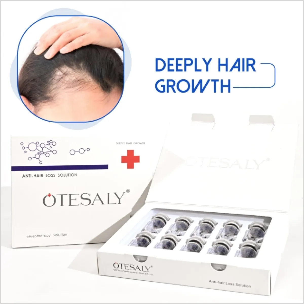 OTESALY Anti-hair Loss Solution - Mesotherapy for Hair Regrowth in Pakistan