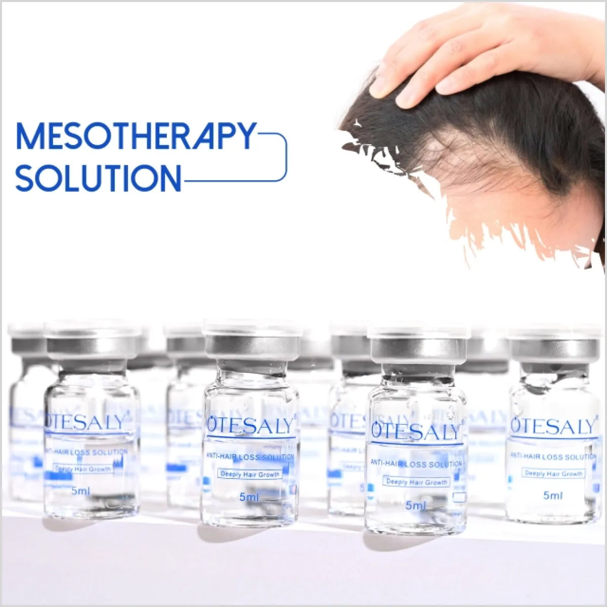 OTESALY Anti-hair Loss Solution - Mesotherapy for Hair Regrowth in Pakistan