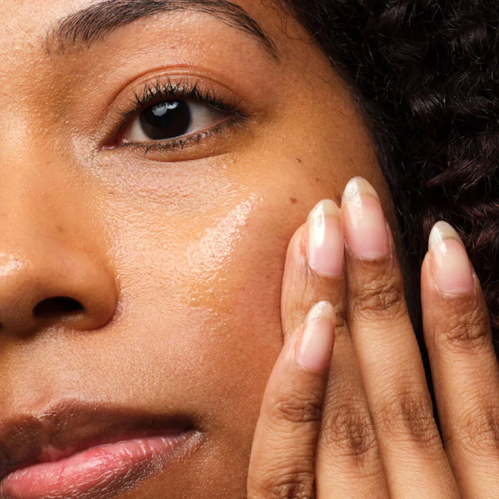 Niacinamide 10% + Zinc 1% – The Ordinary (30ml) for Clear & Balanced Skin